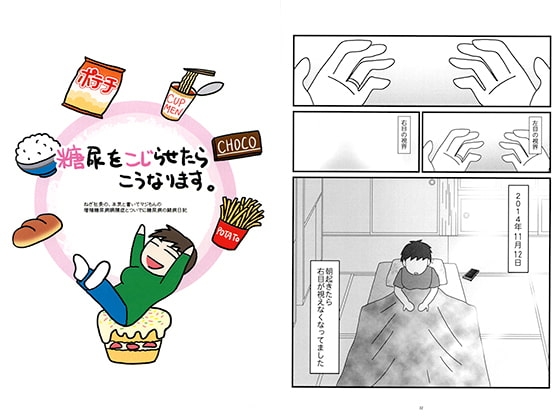 糖尿をこじらせたらこうなります。